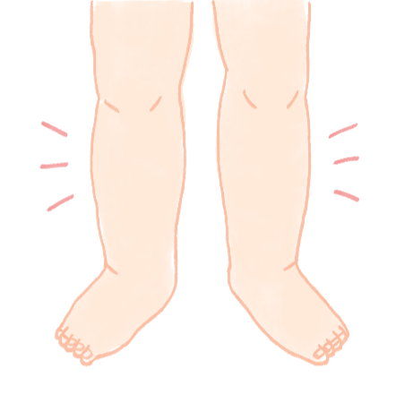 お酒や塩分の摂りすぎによって起こる一時的な足のむくみを示すイラスト