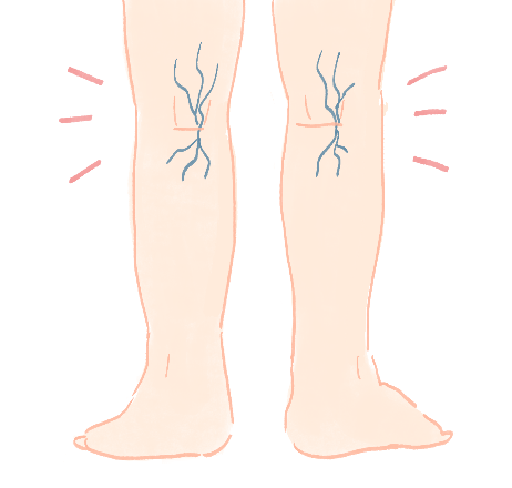 心臓や血管の病気が関係している可能性のある足のむくみを示すイラスト
